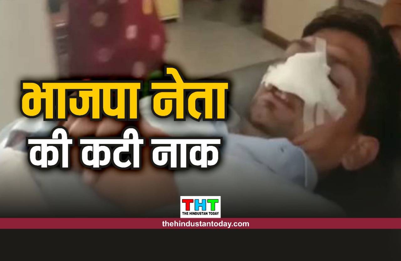 MP BREAKING: भाजपा नेता की कटी नाक, हालत गंभीर, अस्पताल में भर्ती